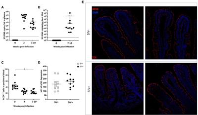 Altered Expression of ACE2 and Co-receptors of SARS-CoV-2 in the Gut Mucosa of the SIV Model of HIV/AIDS